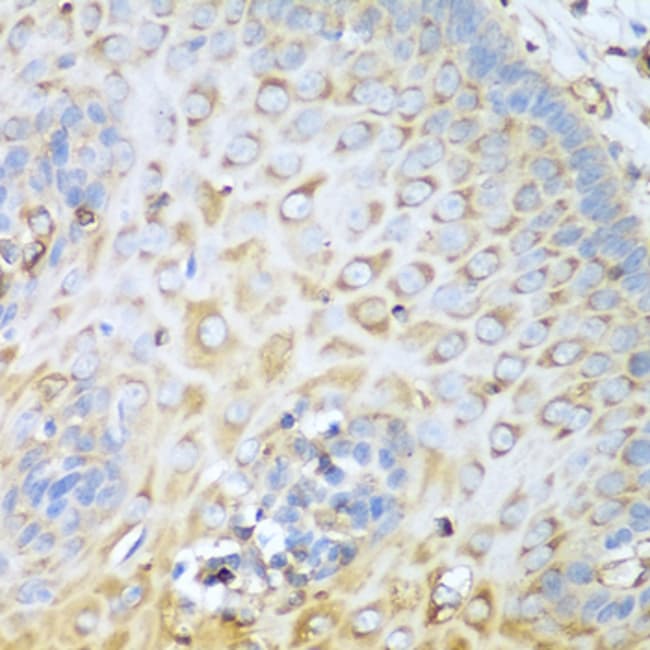 100UL MYH9 ANTIBODY 100 ul