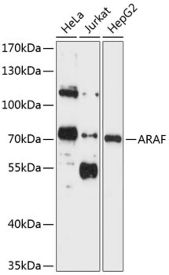 100UL A-RAF ANTIBODY 100 ul