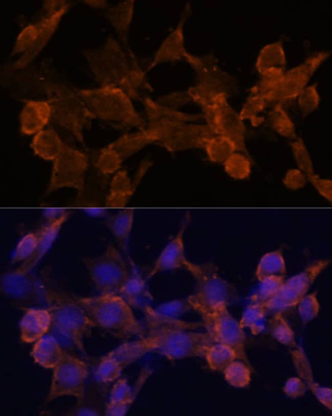 100UL BETA ARRESTIN 1 ANTIBODY 100 ul