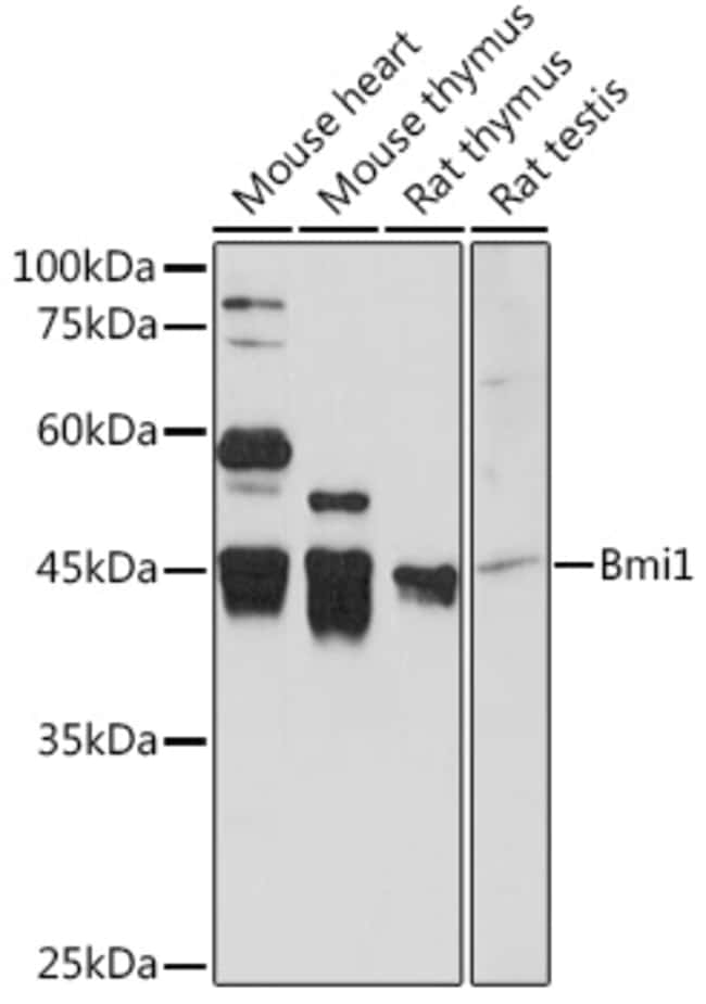 100UL BMI-1 ANTIBODY 100 ul