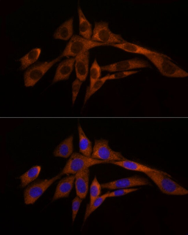 100UL CASPASE 8 ANTIBODY 100 ul