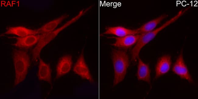 100UL C-RAF ANTIBODY 100 ul