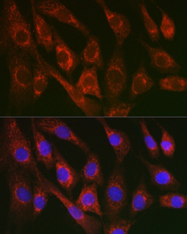 100UL CYTOCHROME C ANTIBODY 100 ul