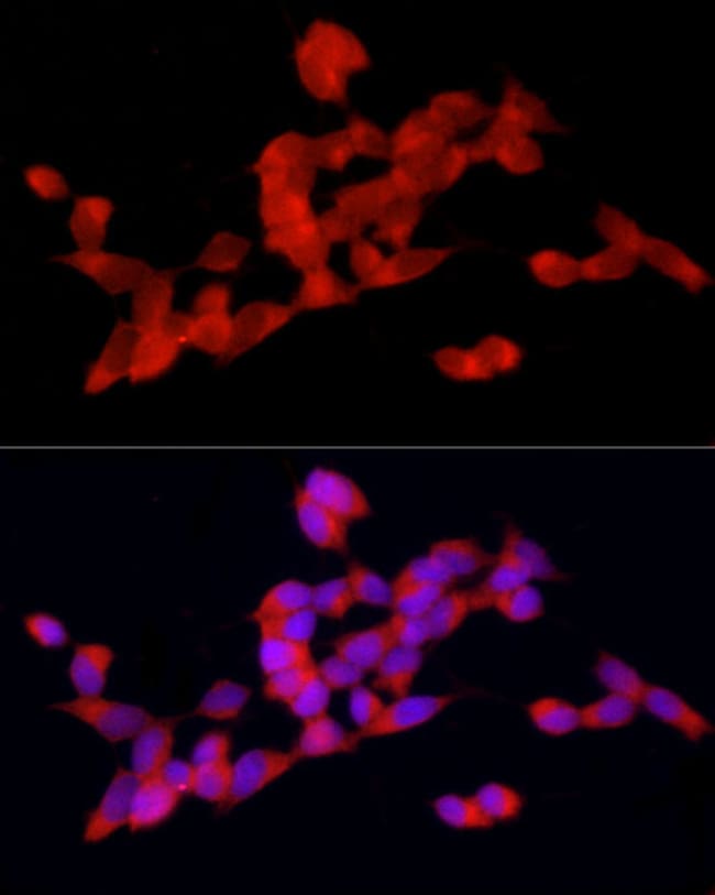 100UL DOK4 ANTIBODY 100 ul