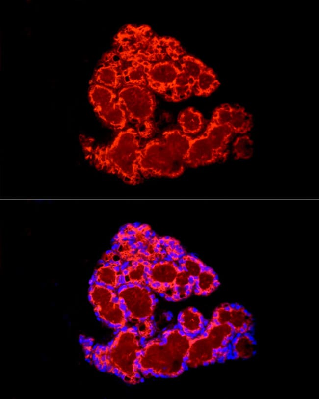 100UL FABP4 ANTIBODY 100 ul
