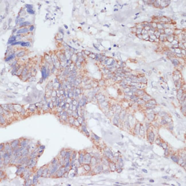 100UL IKK EPSILON ANTIBODY 100 ul