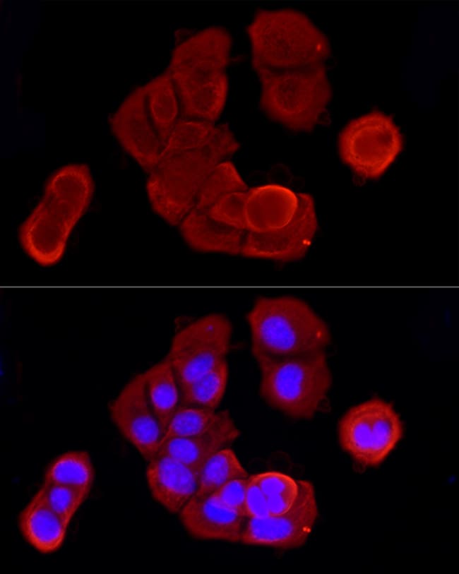 100UL CYTOKERATIN 19 ANTIBODY 100 ul