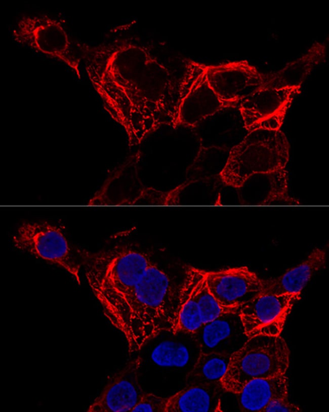 100UL CYTOKERATIN 20 ANTIBODY 100 ul