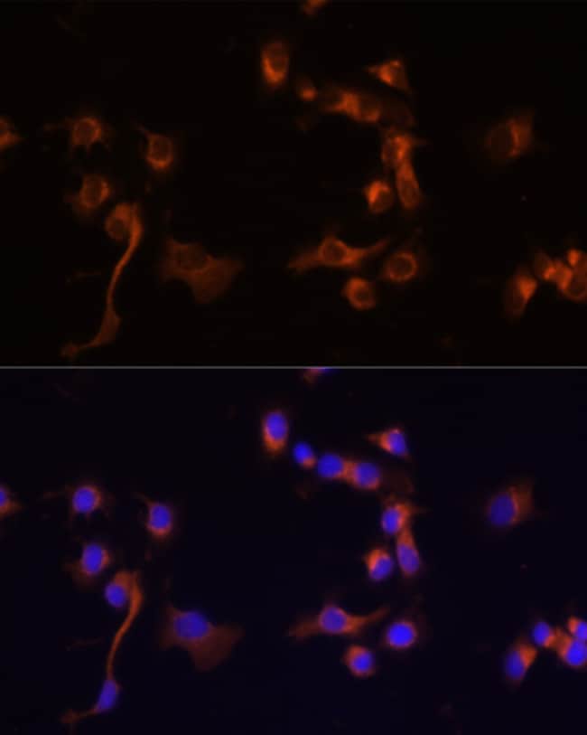100UL C-ABL ANTIBODY 100 ul