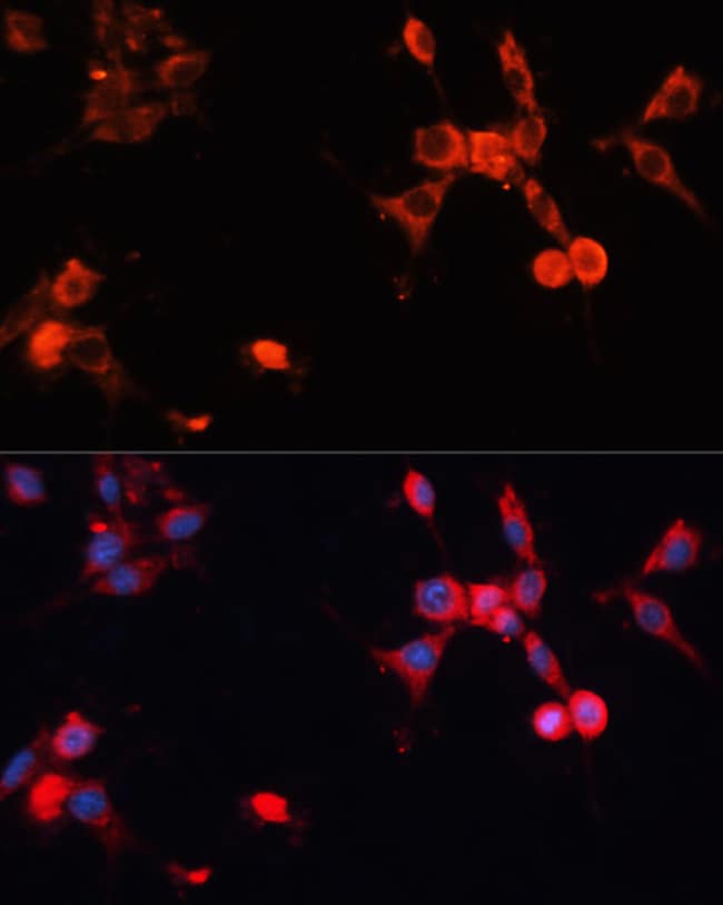 100UL HSP70 ANTIBODY 100 ul