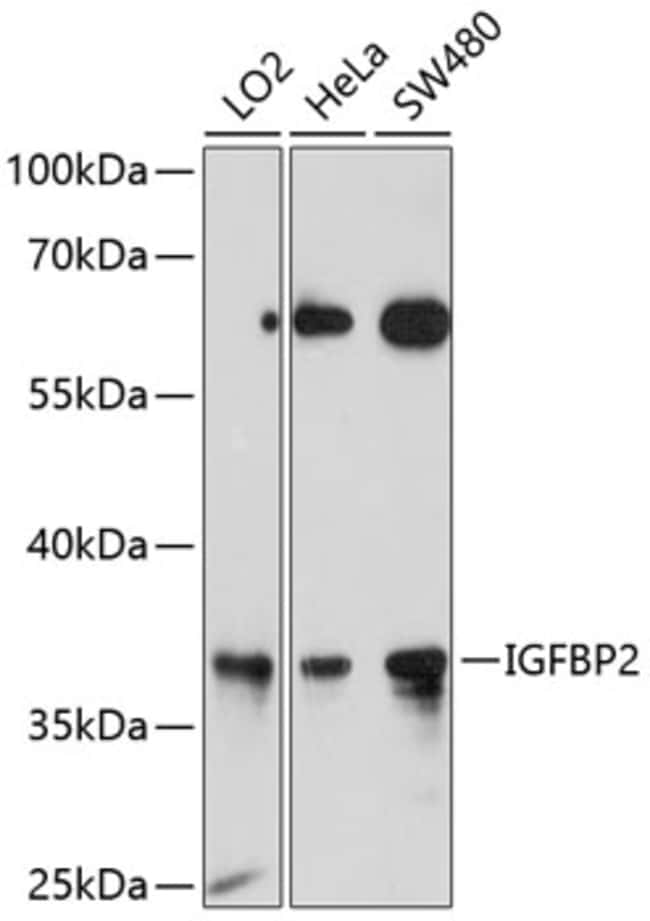 100UL IGFBP2 ANTIBODY 100 ul