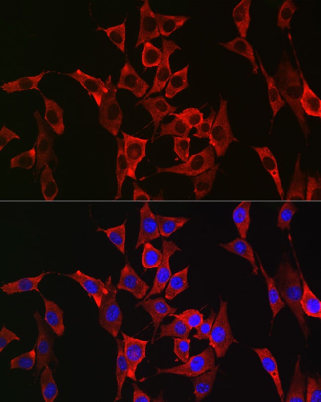 100UL FGFR3 ANTIBODY 100 ul