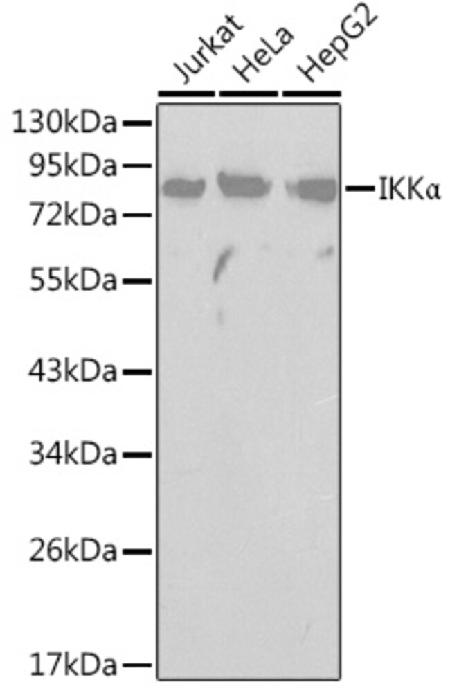 100UL IKK ALPHA ANTIBODY 100 ul
