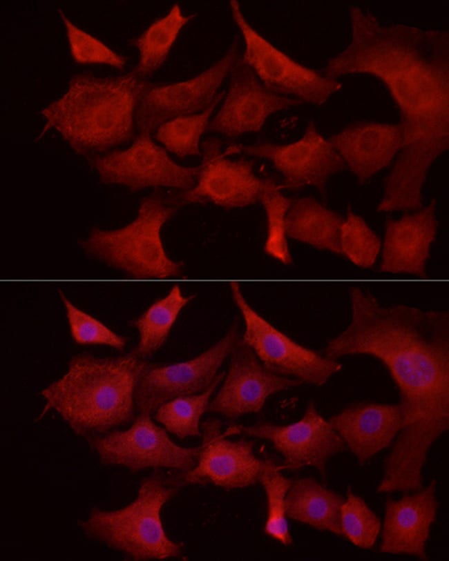 100UL MCL1 ANTIBODY 100 ul