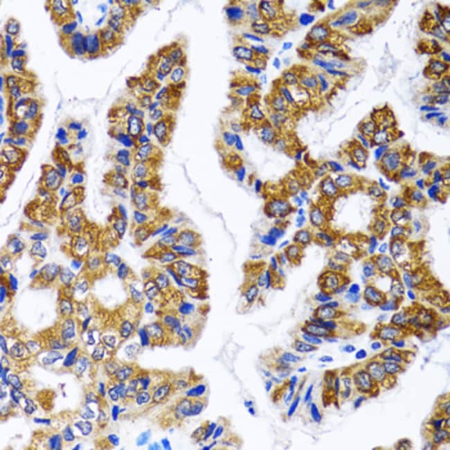 100UL FASN ANTIBODY 100 ul