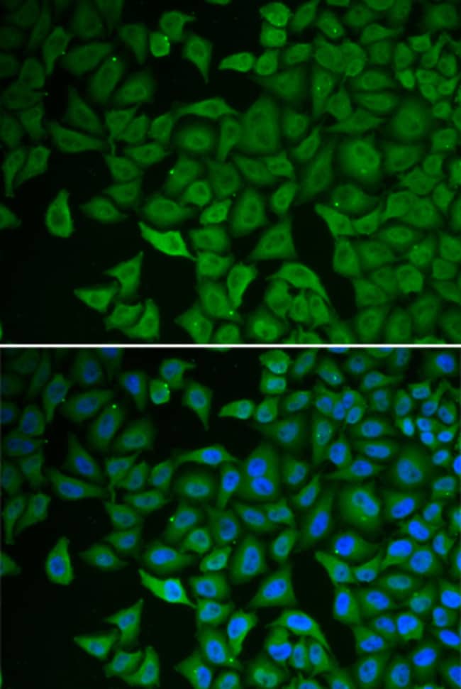 100UL CHK2 ANTIBODY 100 ul