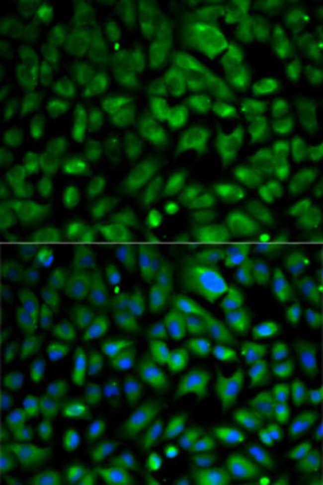100UL EIF4E ANTIBODY 100 ul