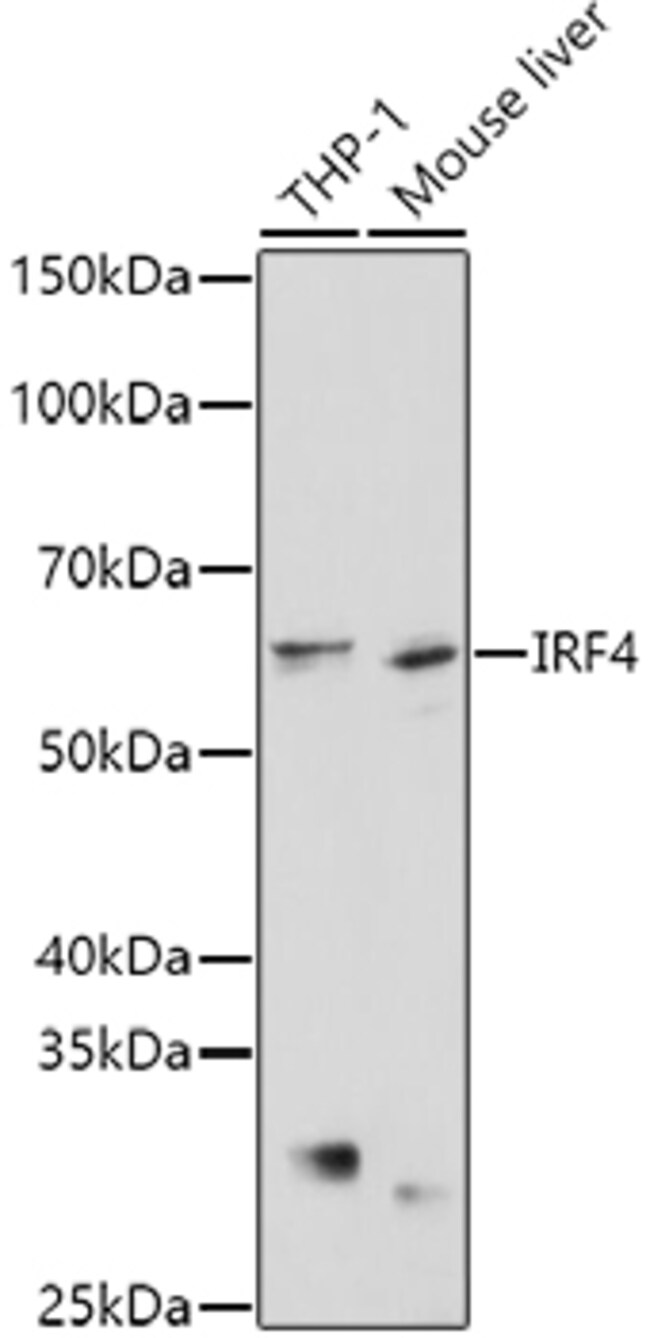 100UL IRF4 ANTIBODY 100 ul
