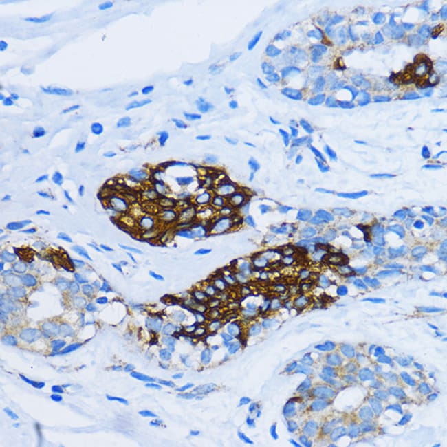 100UL EEA1 ANTIBODY 100 ul