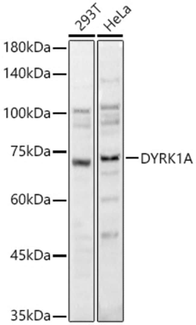 100UL DYRK1A ANTIBODY 100 ul