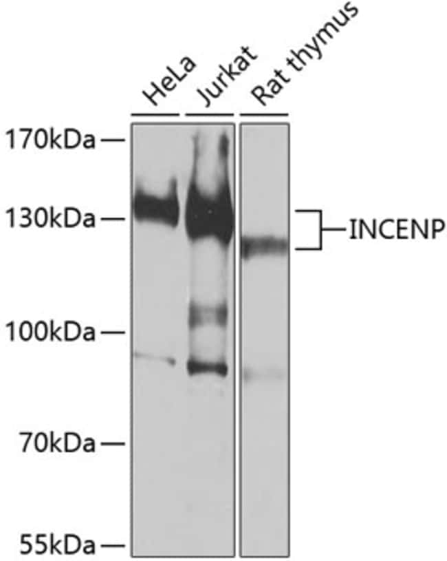 100UL INCENP ANTIBODY 100 ul