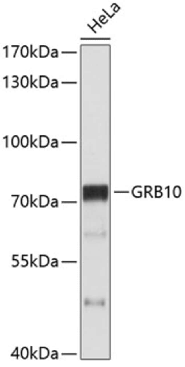 100UL GRB10 ANTIBODY 100 ul
