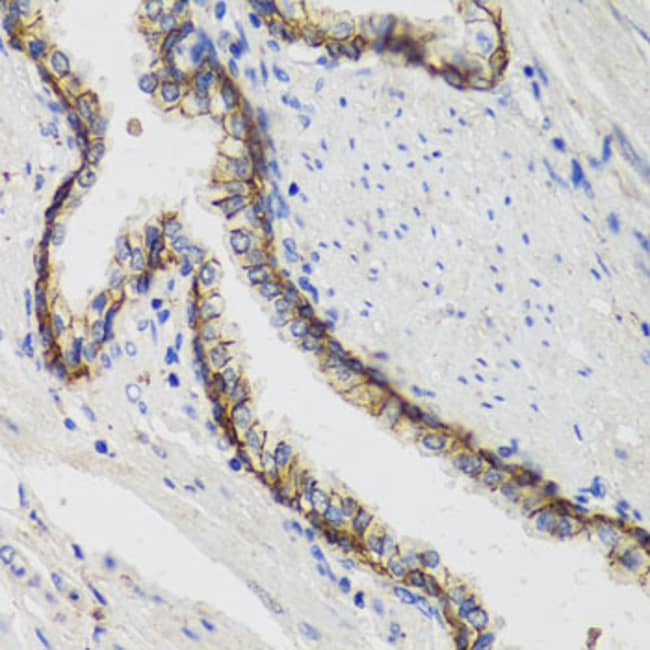 100UL ATP1A1 ANTIBODY 100 ul