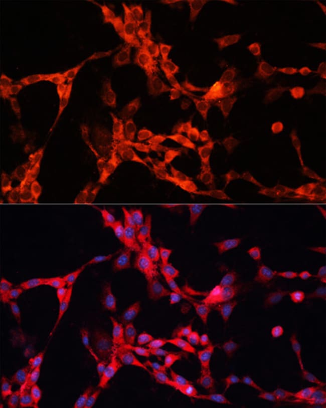100UL GSK3 ALPHA ANTIBODY 100 ul