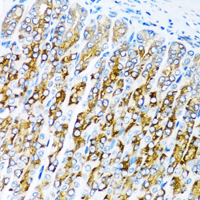 100UL ACVR1C ANTIBODY 100 ul
