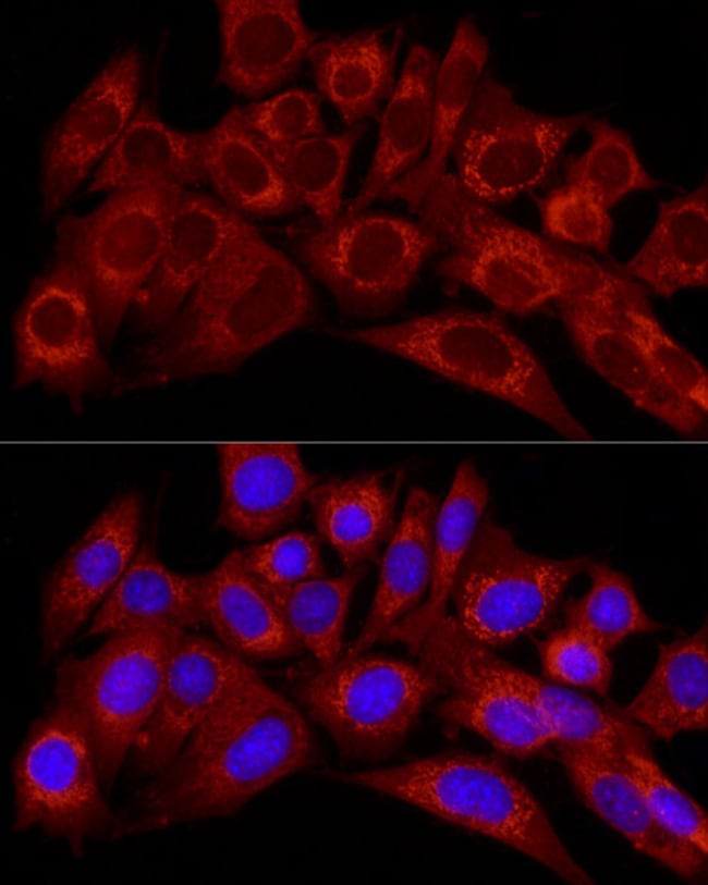 100UL ENDOTHELIN 1 ANTIBODY 100 ul