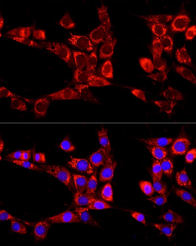 100UL ATG13 ANTIBODY 100 ul