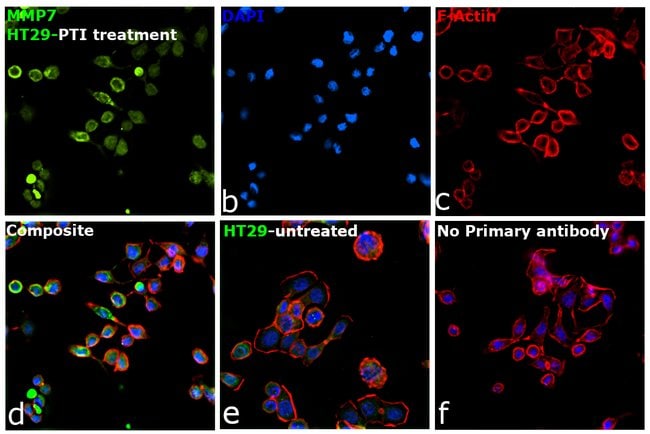 100UL MMP7 ANTIBODY 100 ul