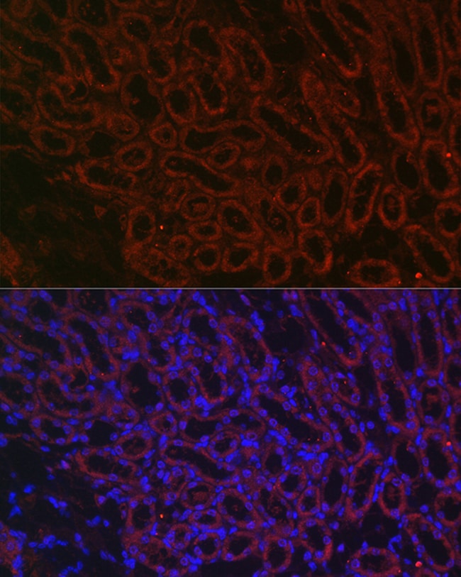 100UL BMP-7 ANTIBODY 100 ul