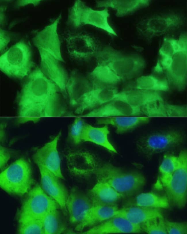 100UL EZRIN ANTIBODY 100 ul
