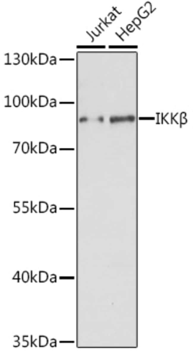 100UL IKK BETA ANTIBODY 100 ul