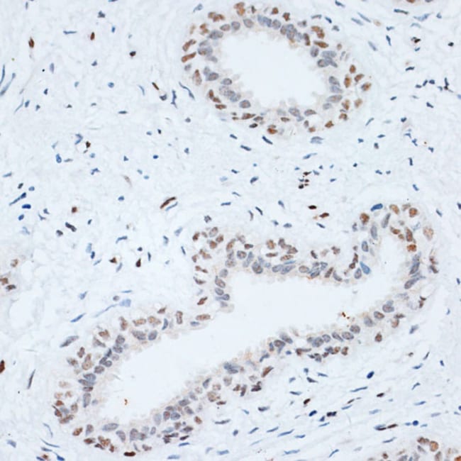 100UL HMGB1 ANTIBODY 100 ul