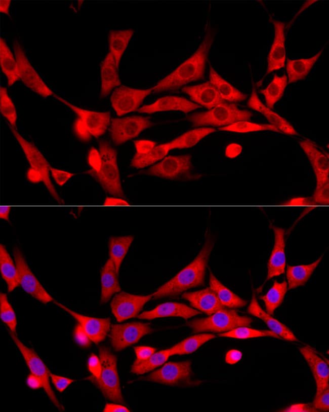100UL C-CBL ANTIBODY 100 ul