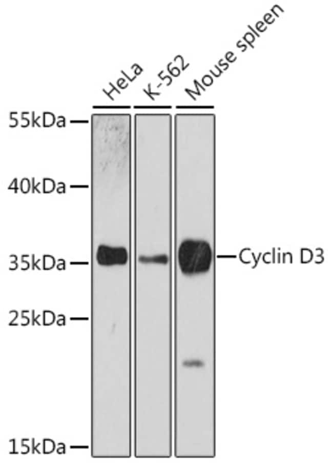 100UL CYCLIN D3 ANTIBODY 100 ul