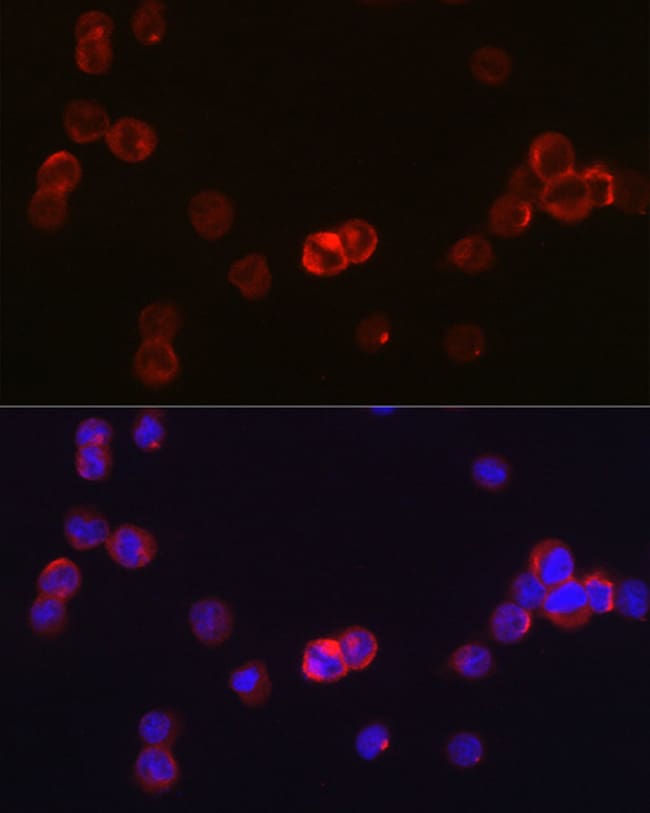 100UL JAK3 ANTIBODY 100 ul