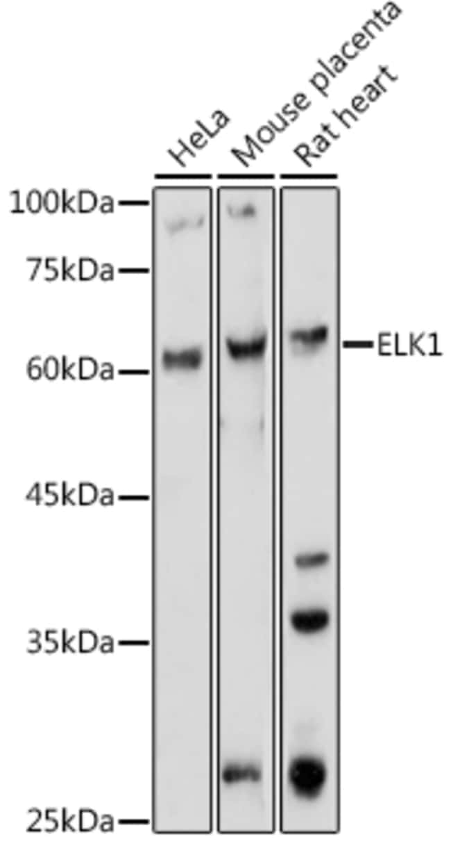 100UL ELK1 ANTIBODY 100 ul
