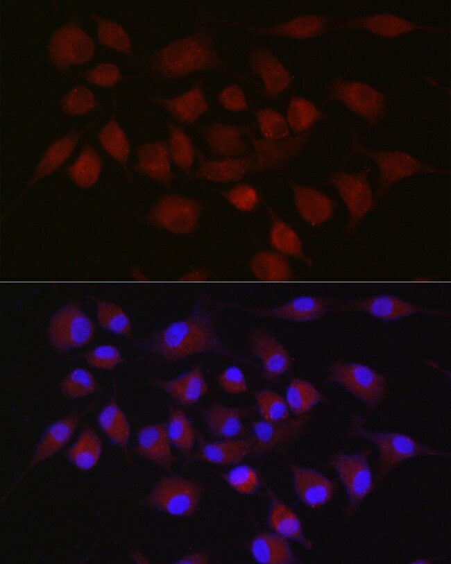 100UL CIAP2 ANTIBODY 100 ul