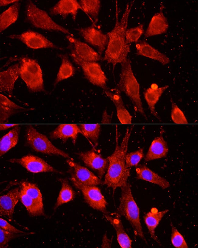 100UL CIAP1 ANTIBODY 100 ul