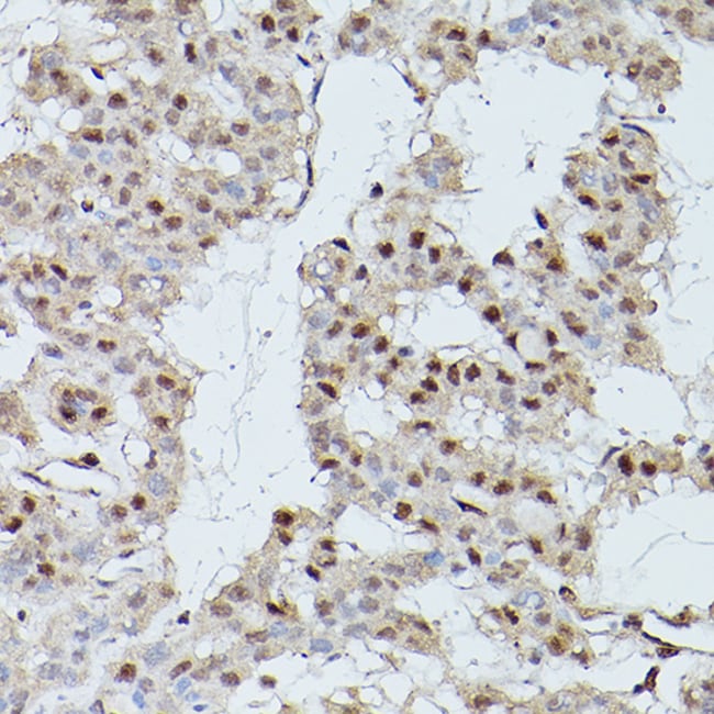 100UL CDK9 ANTIBODY 100 ul