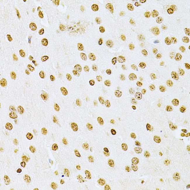 100UL ILK ANTIBODY 100 ul