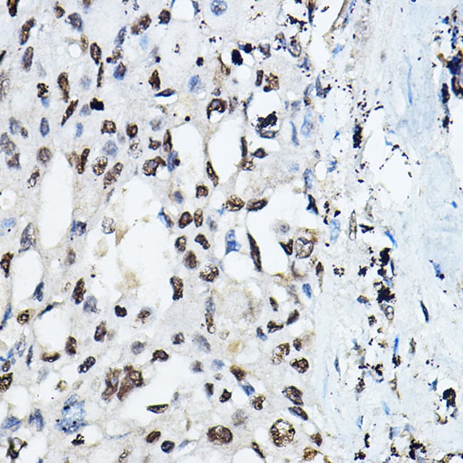100UL C/EBP ALPHA ANTIBODY 100 ul