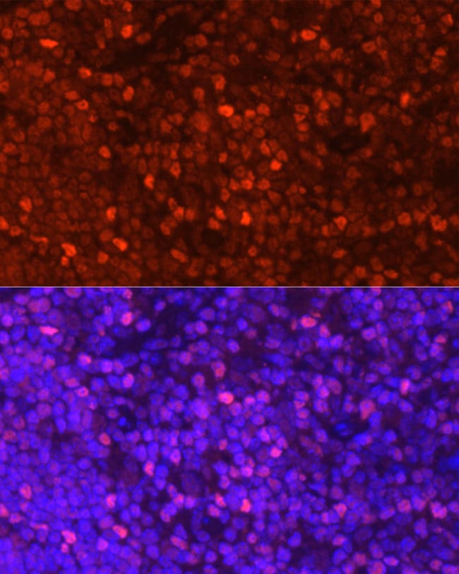 100UL LEF1 ANTIBODY 100 ul