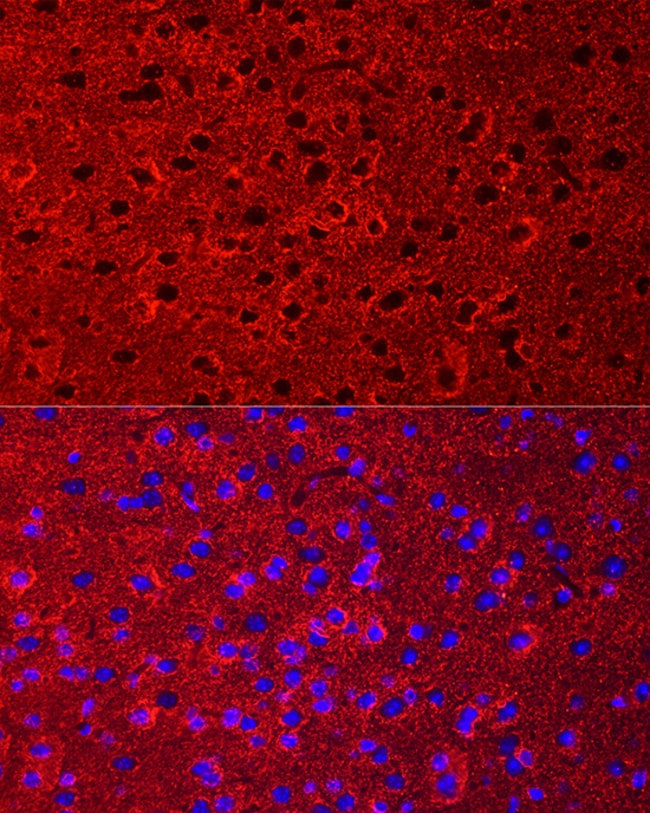100UL GLT-1 ANTIBODY 100 ul