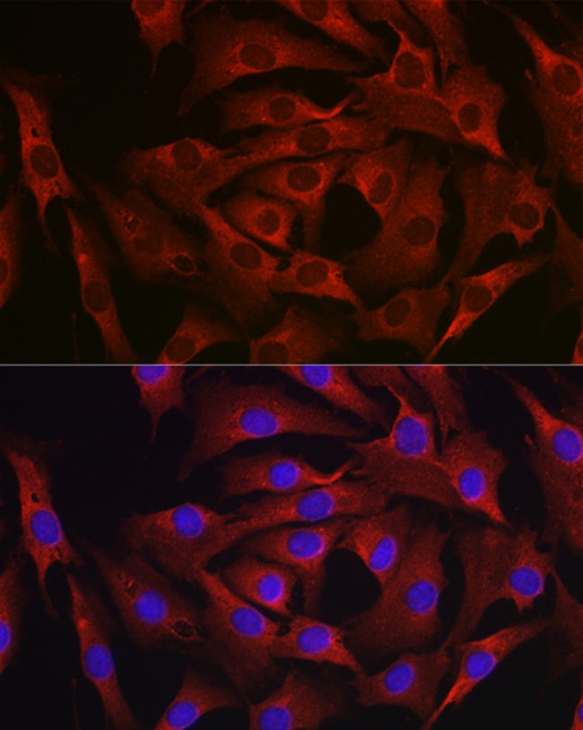 100UL MARCKS ANTIBODY 100 ul