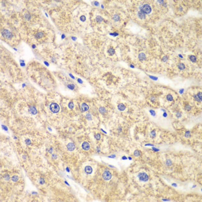 100UL ACADS ANTIBODY 100 ul