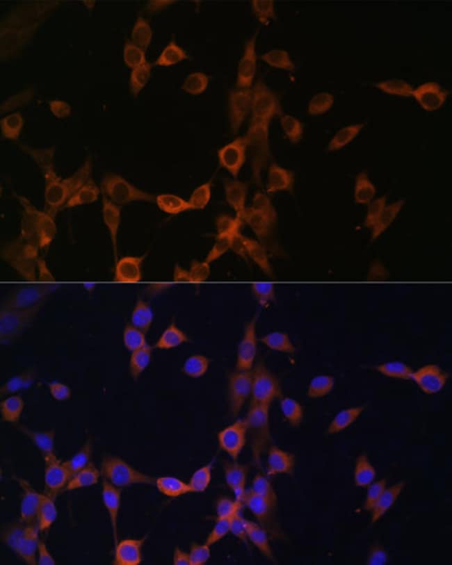100UL CALCINEURIN B ANTIBODY 100 ul